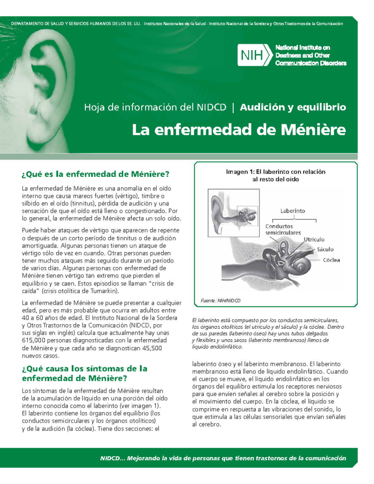 Menieres Disease-Spanish - NIDCD... Mejorando la vida de personas que ...