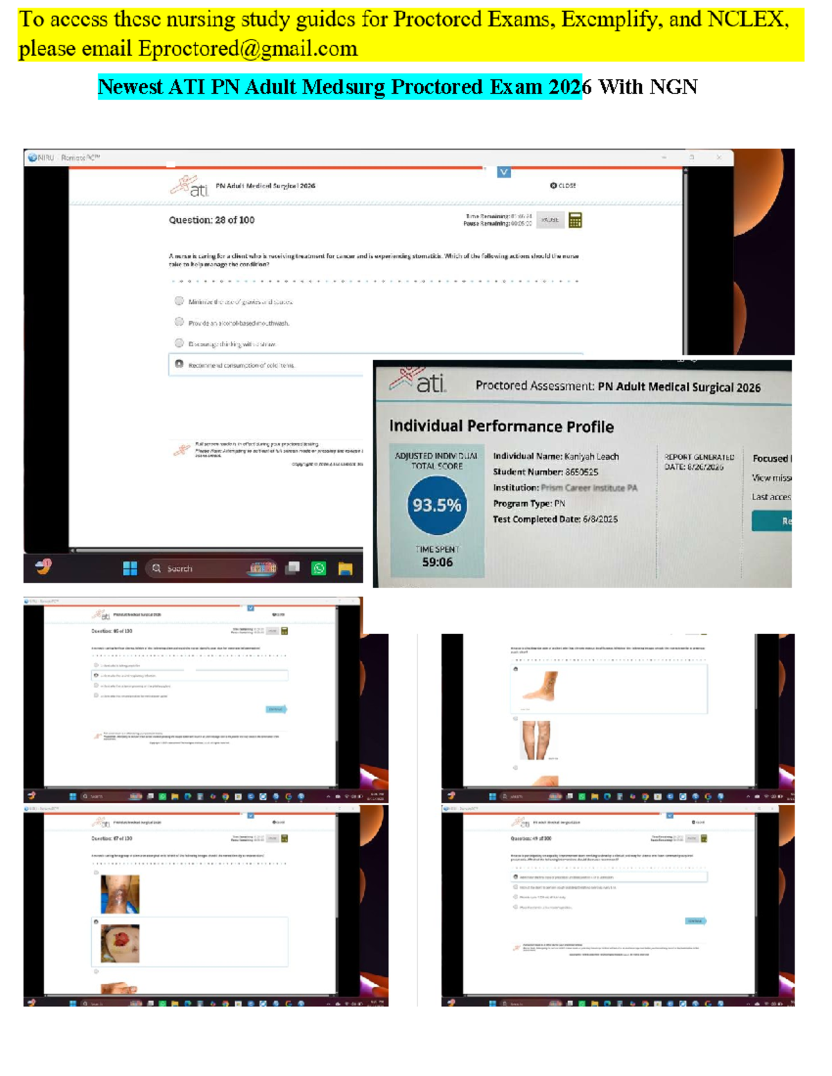 ATI PN Adult Medsurg Proctored Exam Retake 2026: Key Q&A Insights - Studocu
