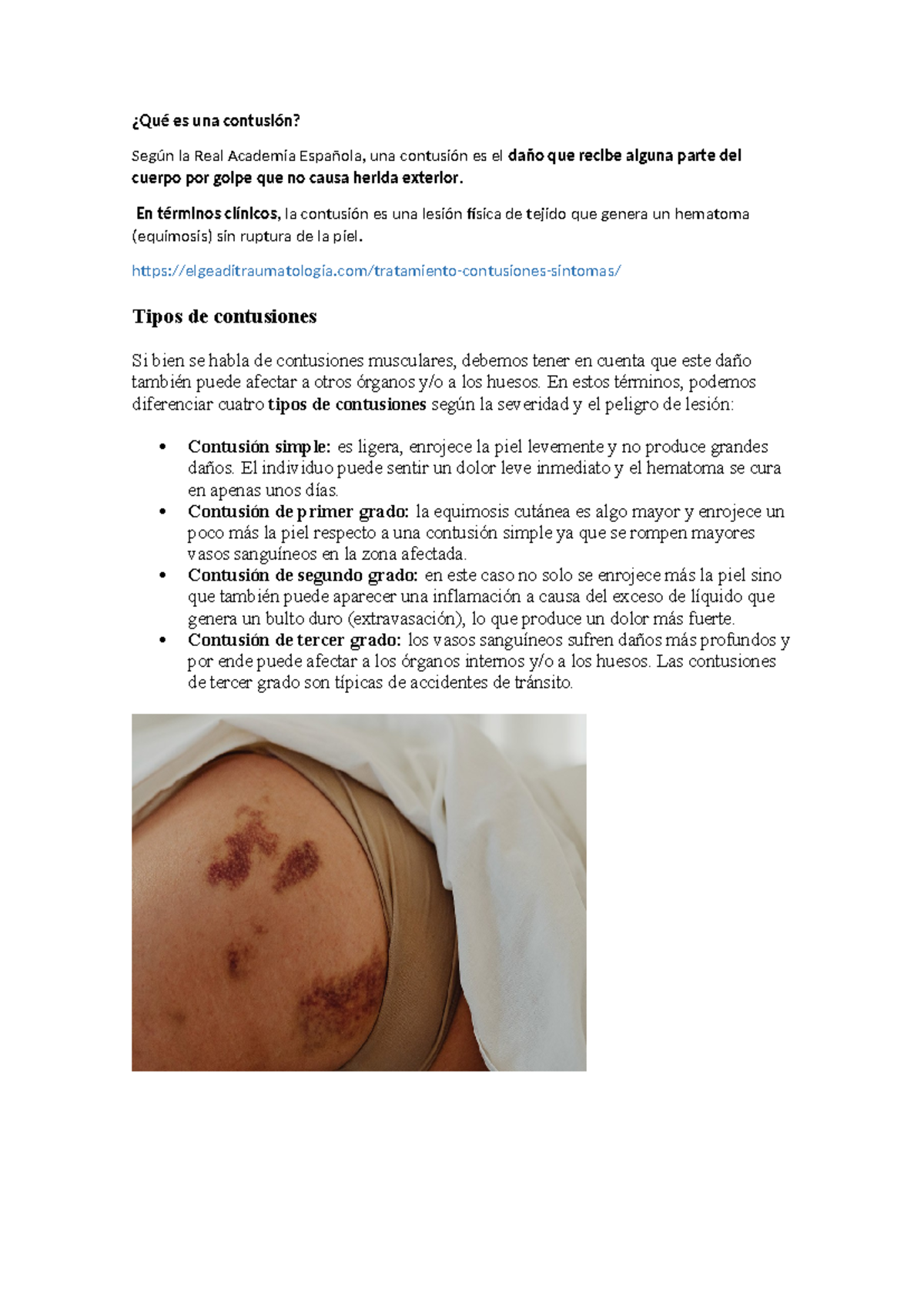Qué es una contusión: Resumen y Tipos de Lesiones (Curso de Salud ...