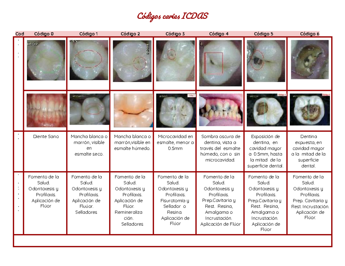 Códigos ICDAS de Caries: Diagnóstico y Manejo Clínico - Studocu