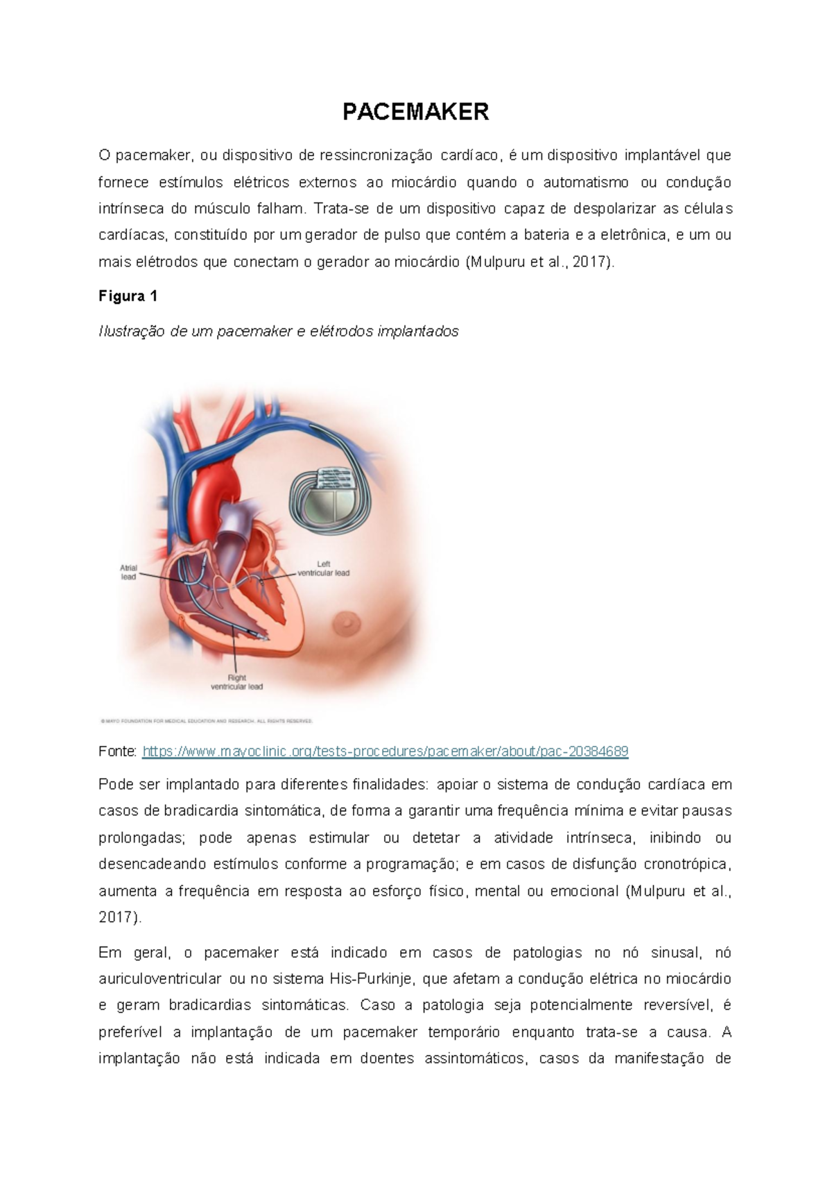 PACEMAKER - Dispositivo e Cuidados no Ensino Clínico - Studocu