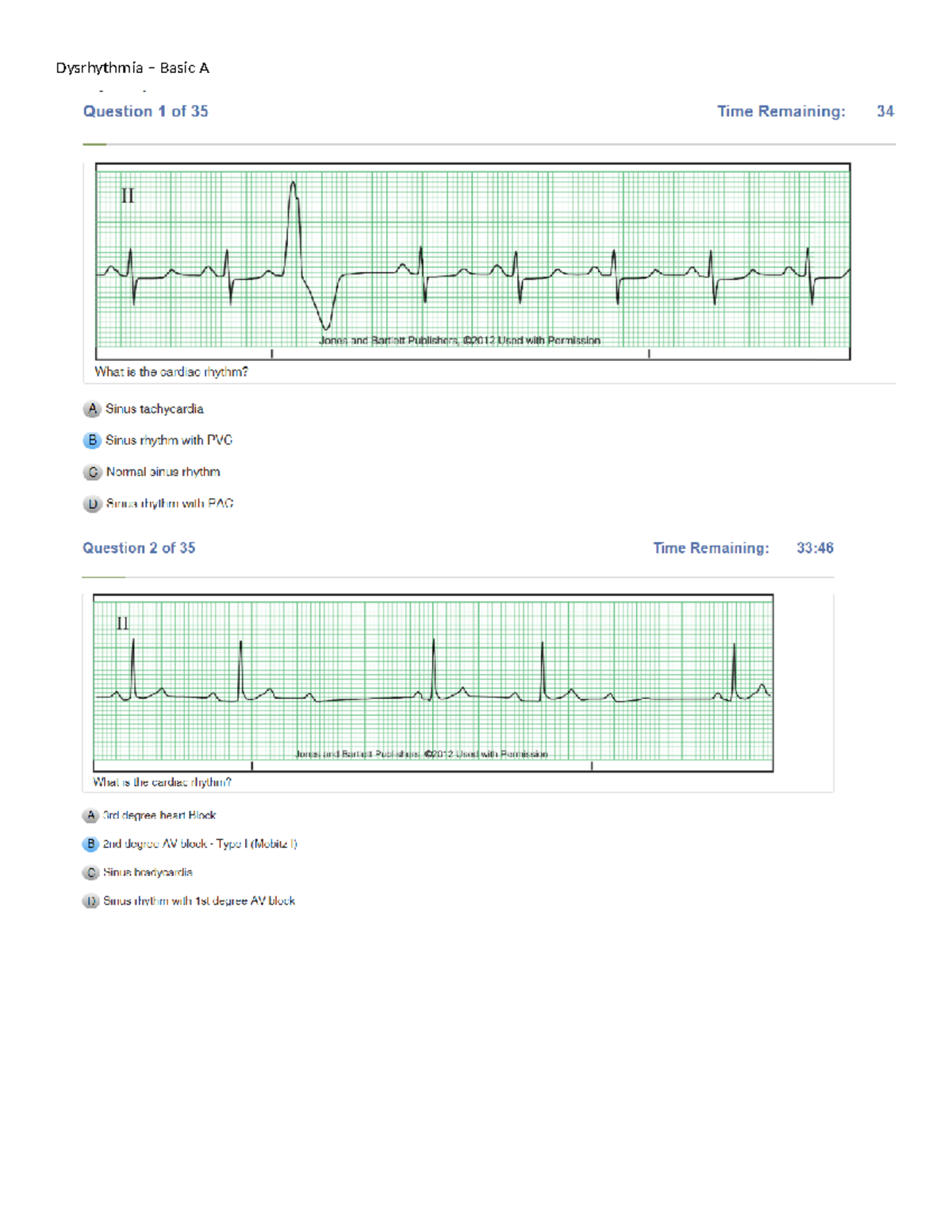 Dysrhythmia - Telemetry Exam Study Guide for Basic A Students - Studocu