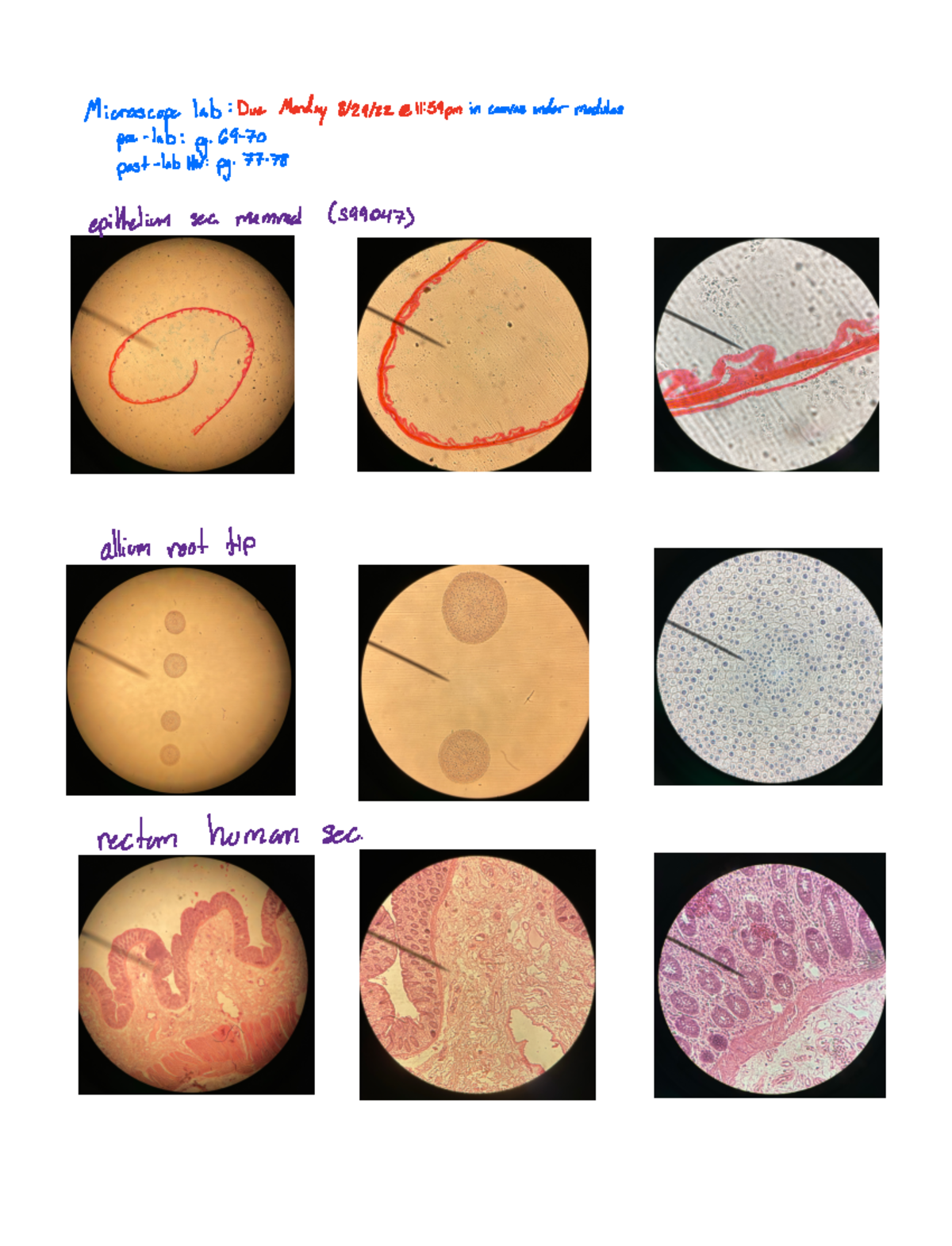 Microscope lab 8-22 - Lab slides and descriptions - BIOL 1500 ...