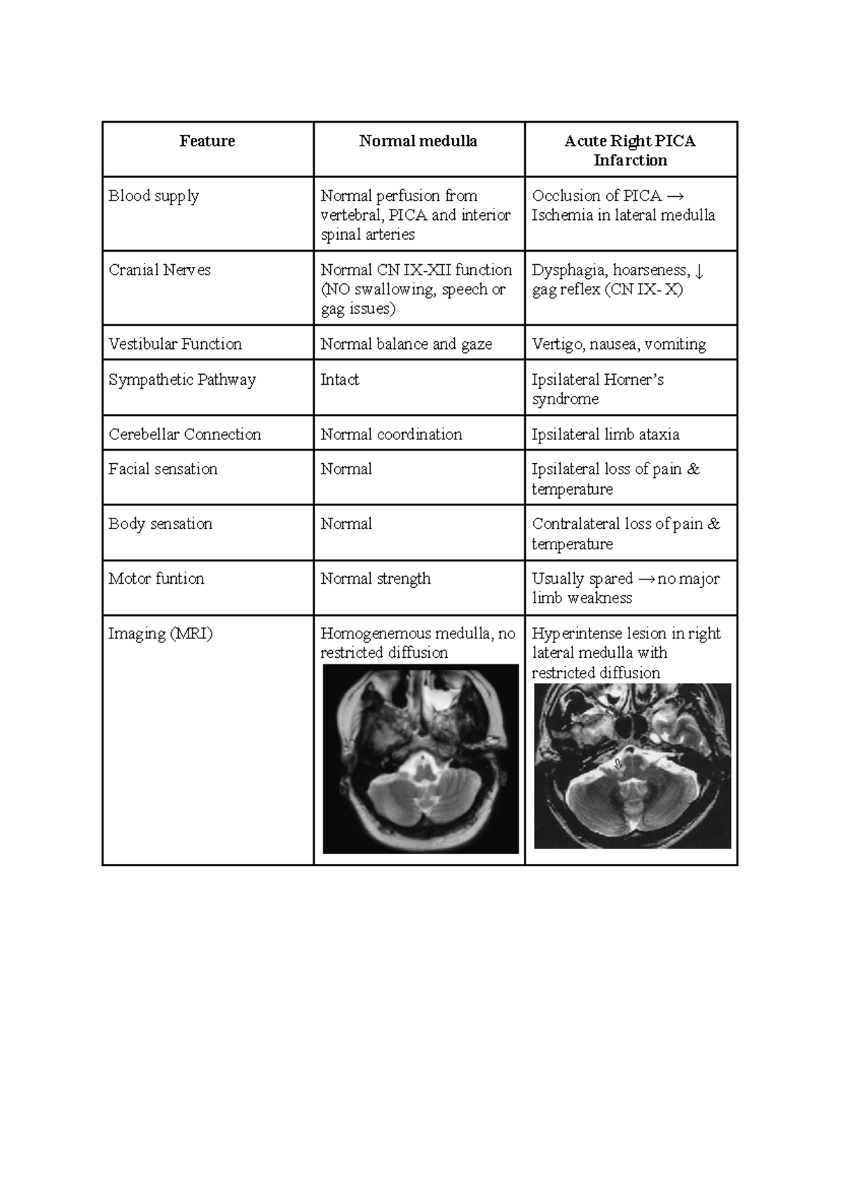 CNS PBL - Acute Right PICA Infarction Case Study Analysis - Studocu