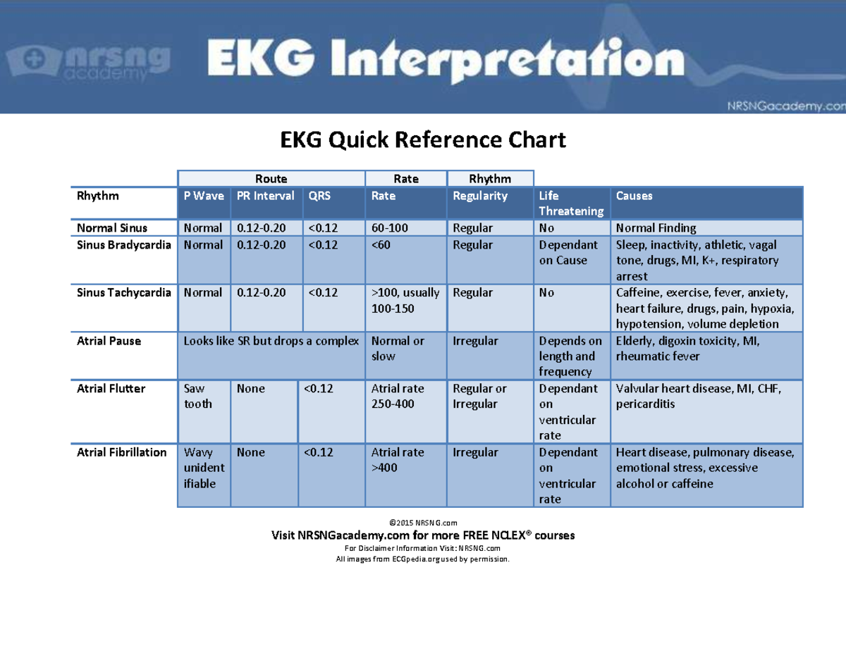 EKG Quick Reference Chart for Rhythm Analysis (3) - Studocu