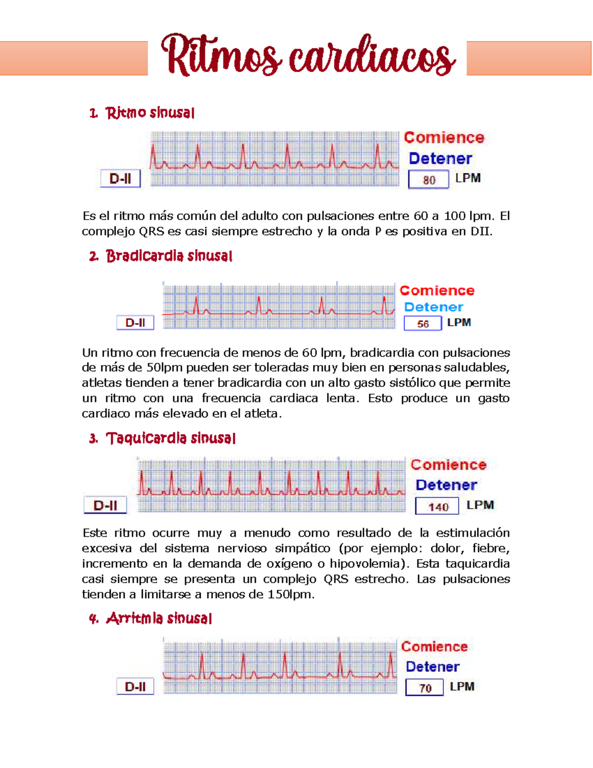 Ritmos Cardiacos: Clasificación y Características Esenciales - Studocu