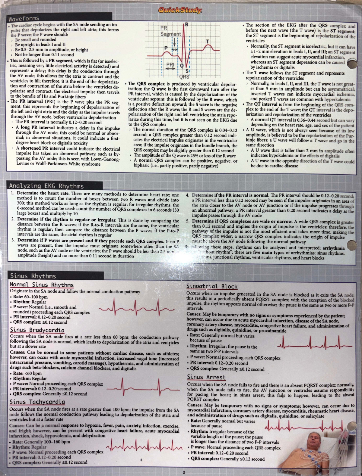 EKG Waveforms and Cardiac Cycle Analysis - Course Code: EKG - Studocu
