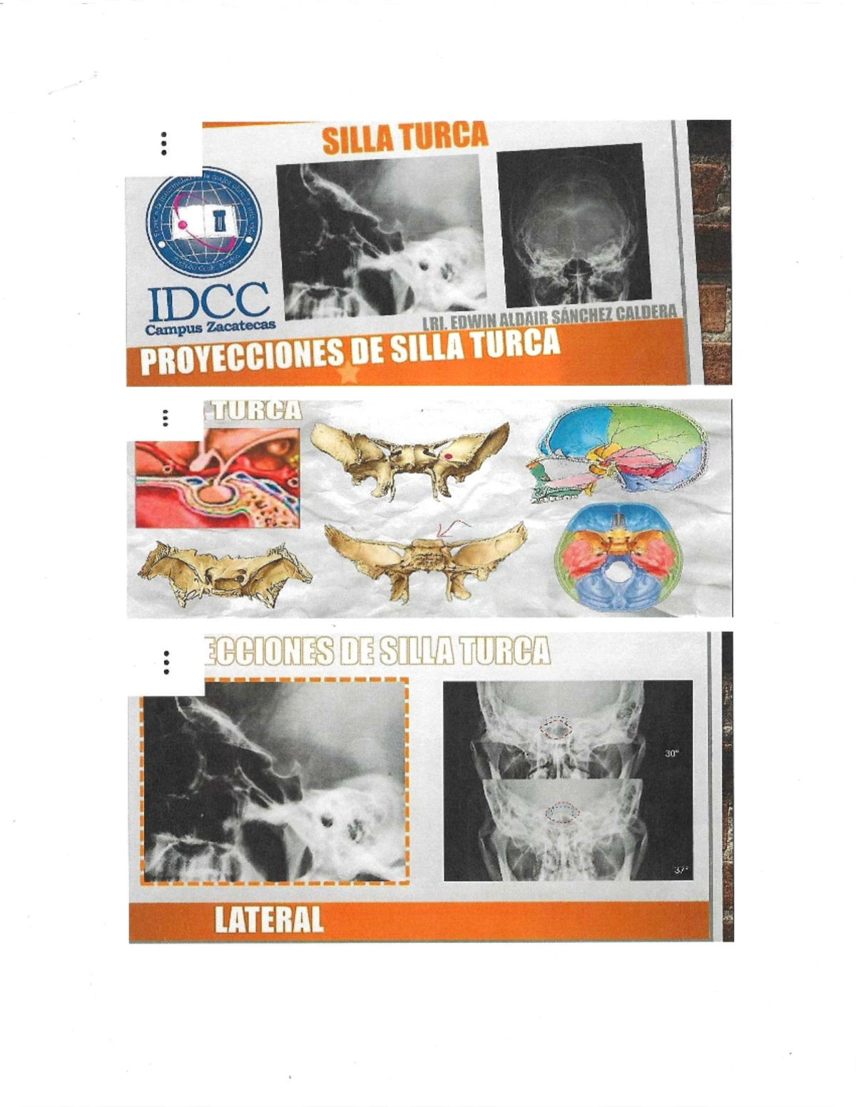 Proyecciones de Silla Turca - Estudio Radiográfico IDCC - Studocu