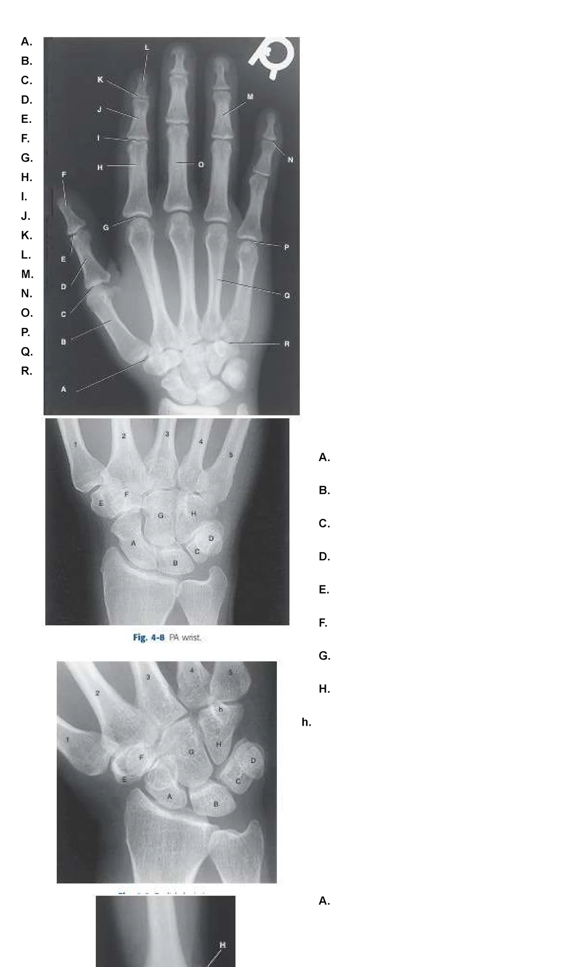 5 6192895309534728807: Cluster 1 Compilation Exam Review for Radiology ...