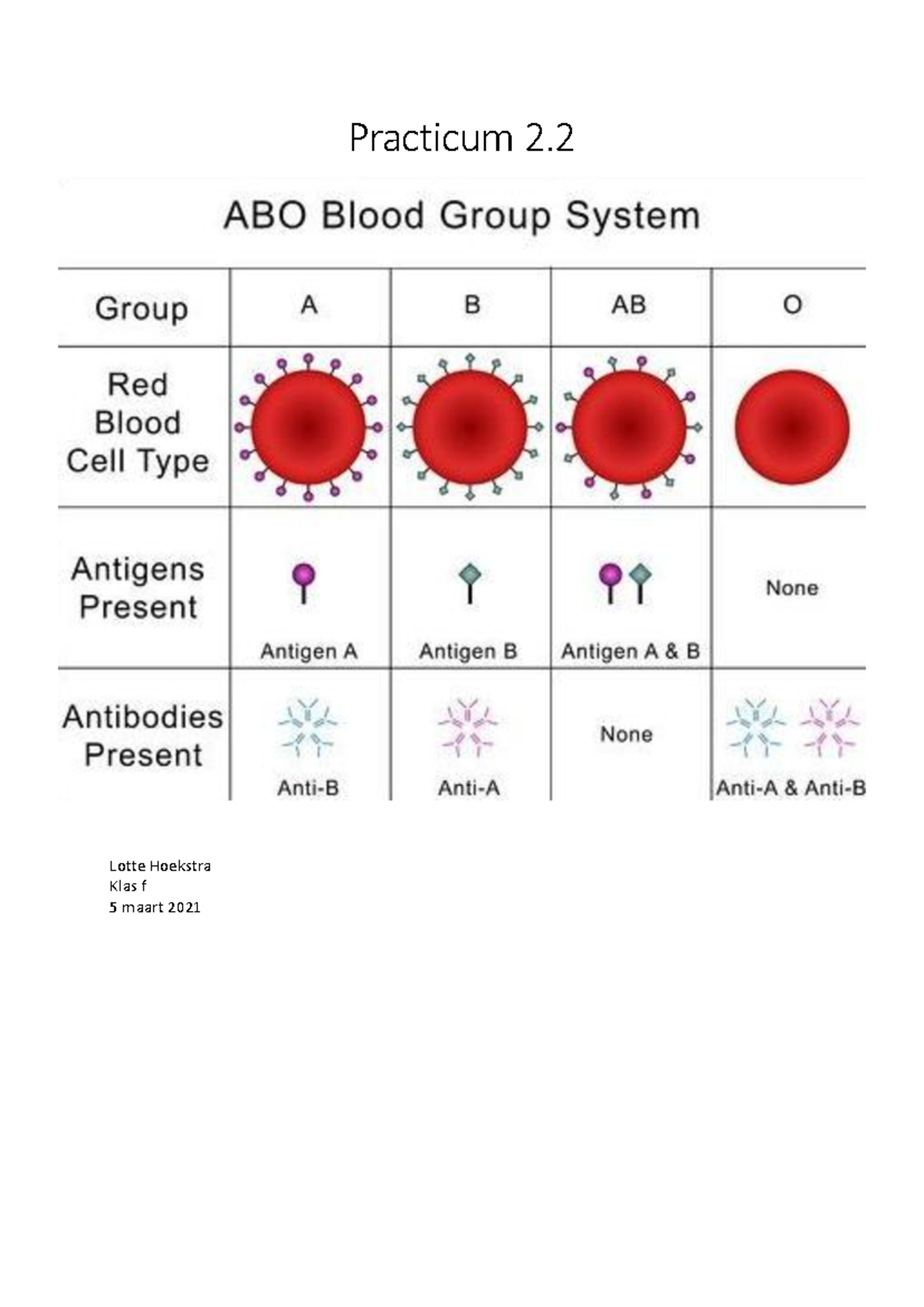 Practicum 2: AB0 Bloedgroep en Rhesus D Factor Analyse - Studeersnel