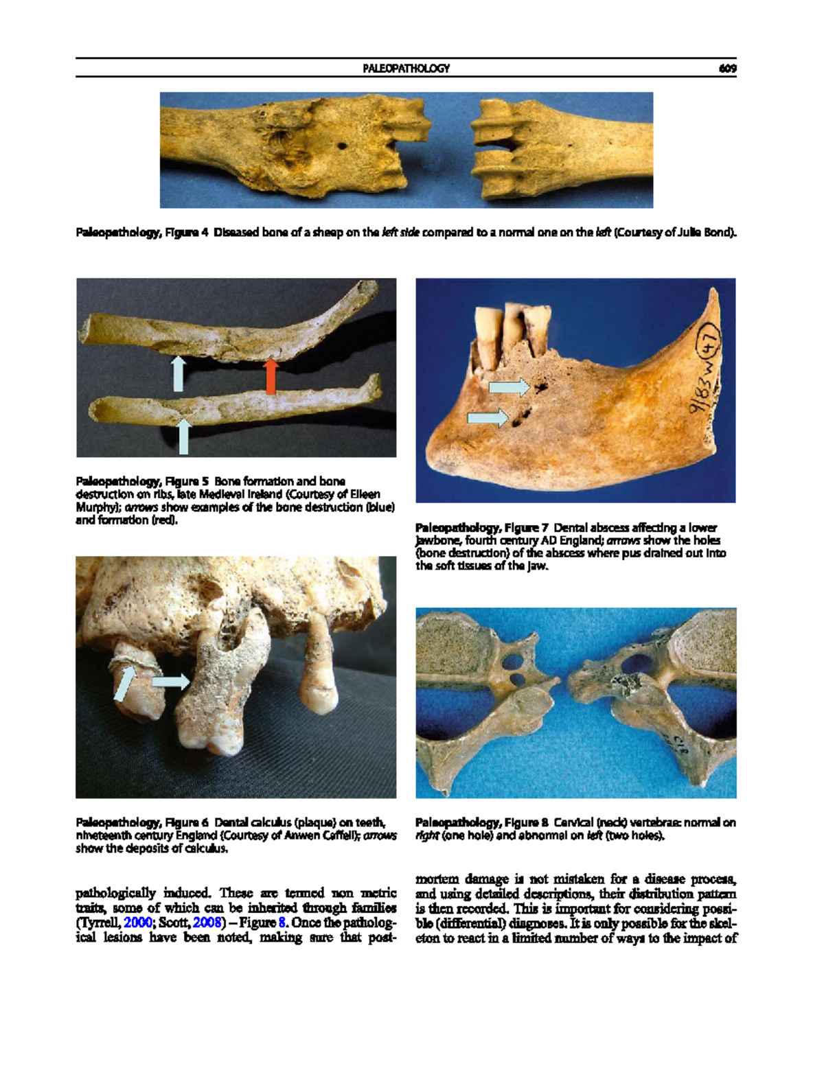Paleopathology: Analyzing Skeletal Diseases - Studocu