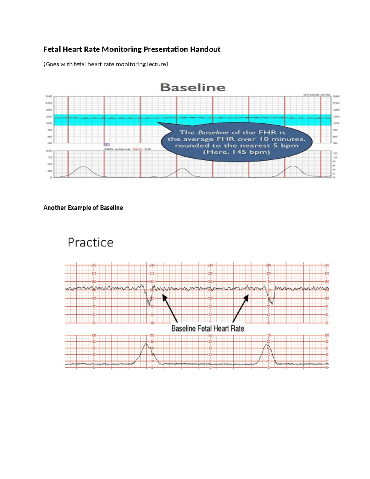 Fetal Heart Rate Monitoring Practice Strips (Lecture Handout) - Studocu