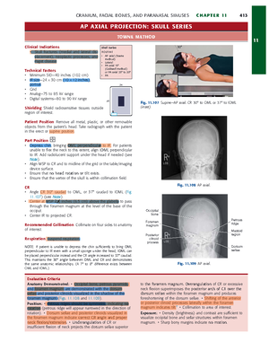 Trunk Organs Practical Reference: Chest & Abdomen Imaging Techniques ...
