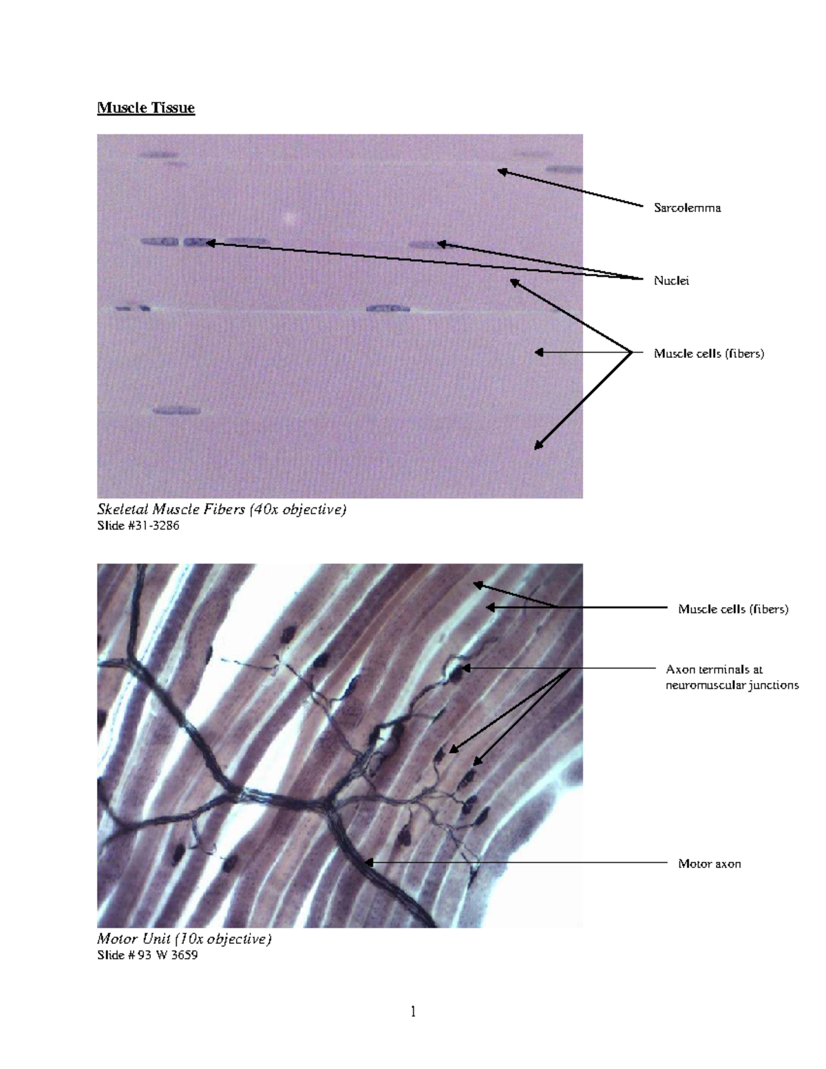 Muscle Tissue - BIO 201 - Muscle Tissue Sarcolemma Nuclei Muscle cells ...