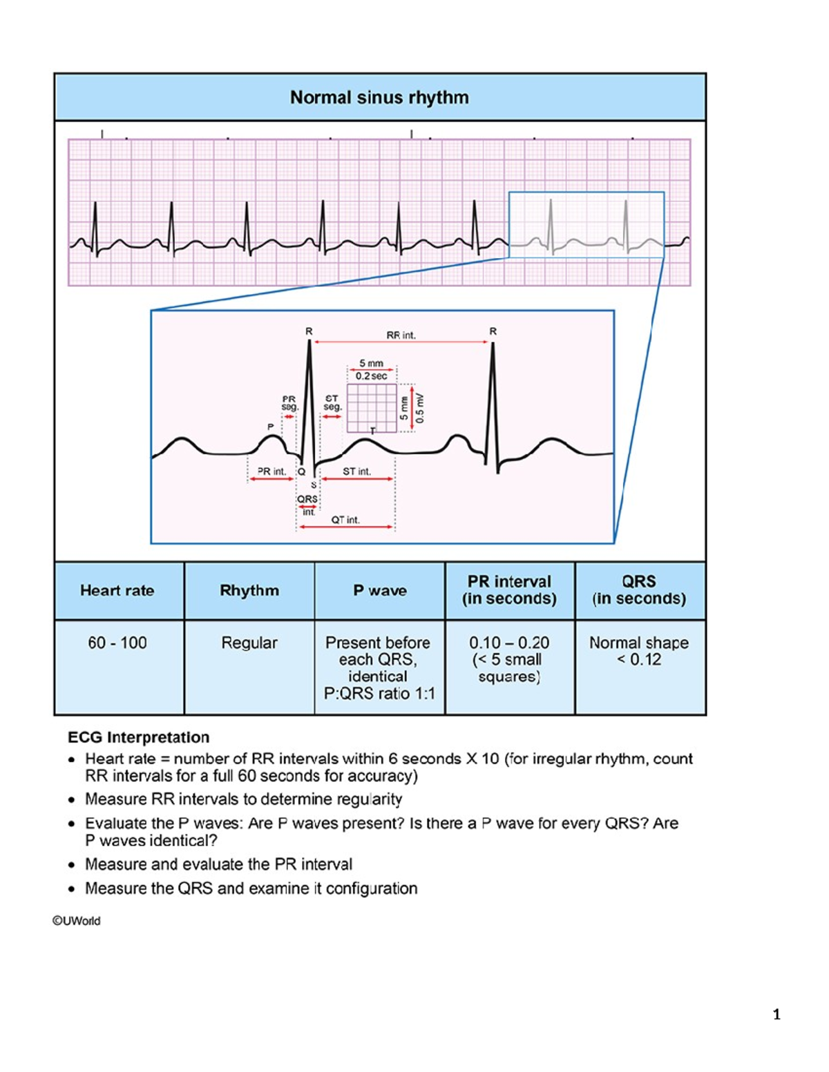 U-World EKC Strips: Sinus Bradycardia, Tachycardia & Atrial ...