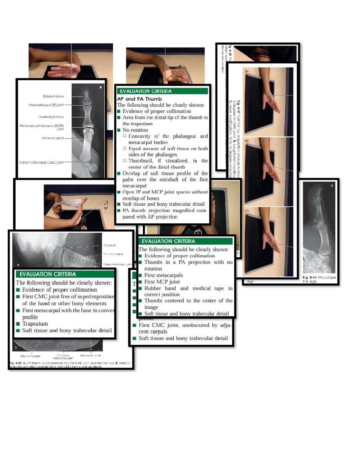 Evaluation Criteria for Internal Arm Rotation: Thumb Projections - Studocu