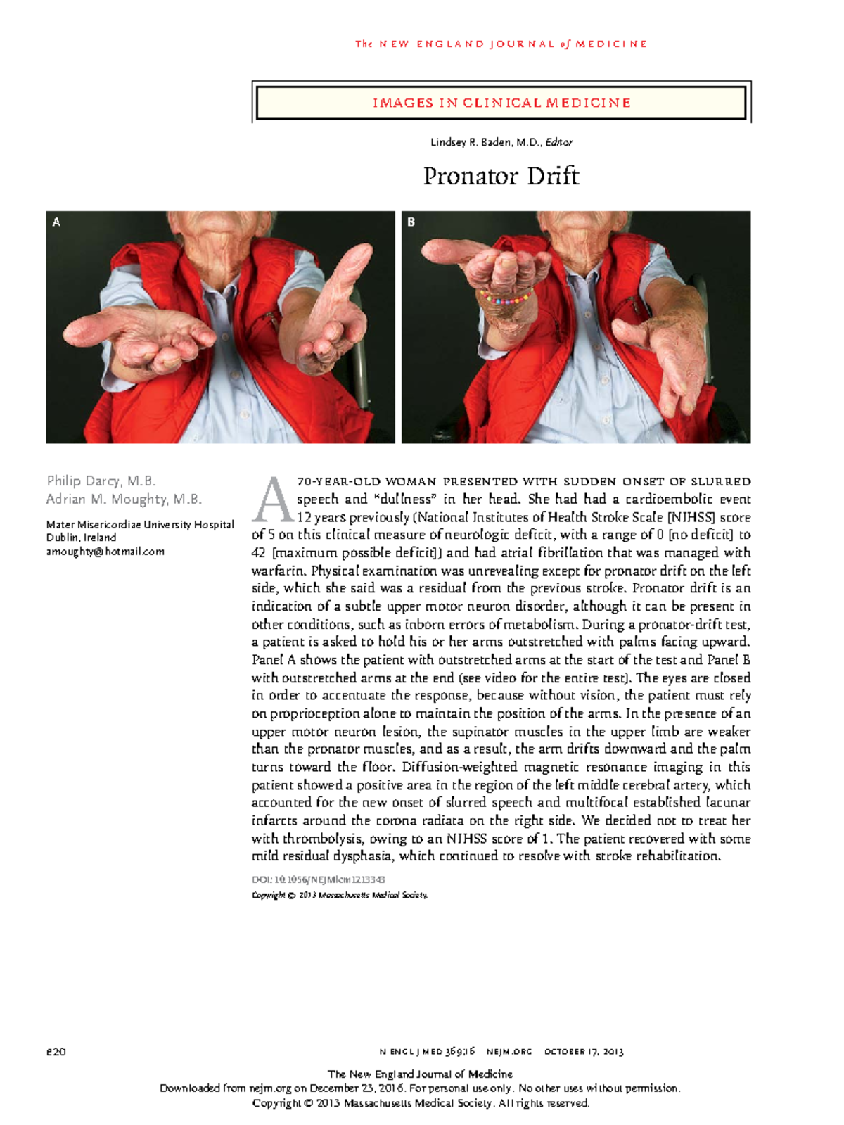 What Is Pronator Drift