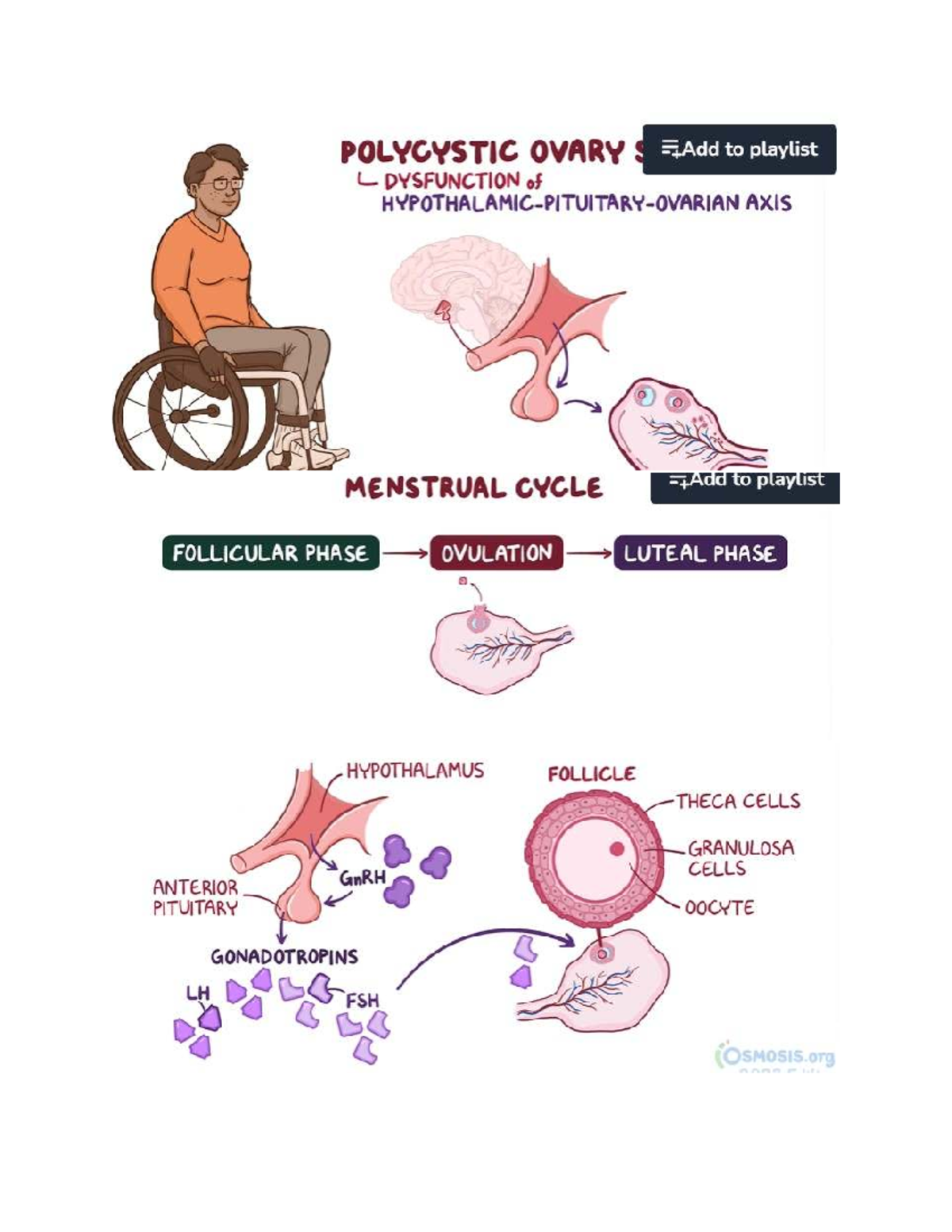 W14a - PCOS Overview and Hormonal Mechanisms Notes - Studocu