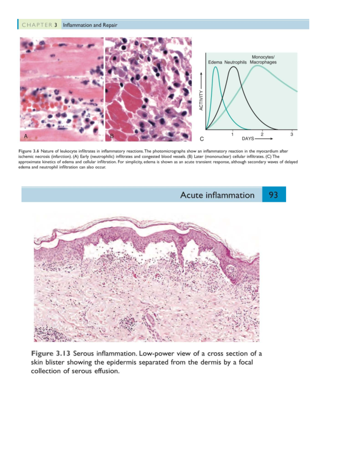 CHAPTER 3 Inflammation and Repair: Key Concepts and Notes - Studocu