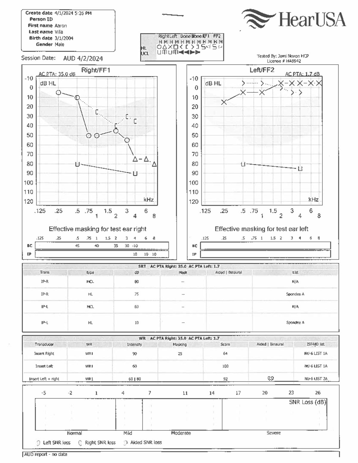 Hearing Exam Report - Patient Aaron Villa (FE11) - Studocu