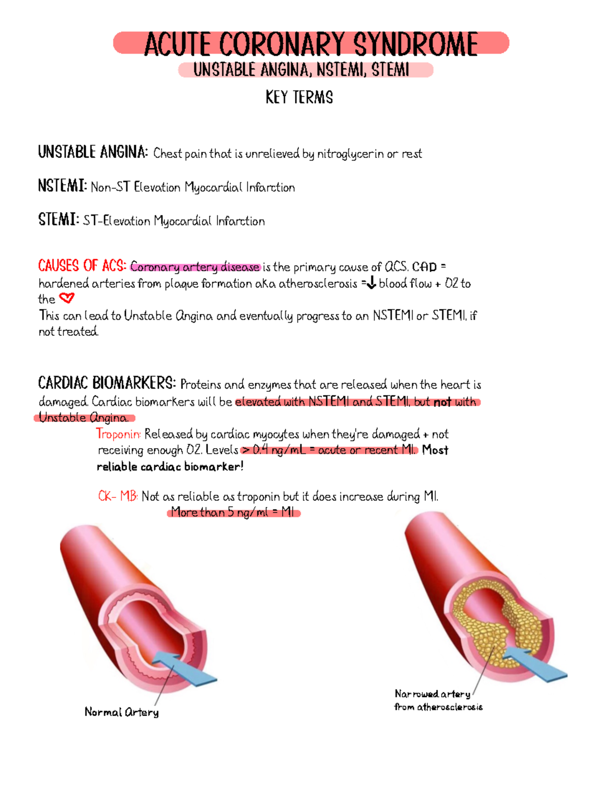 ACS bundle - Notes - Unstable angina, Nstemi, stemi ####### Key terms ...