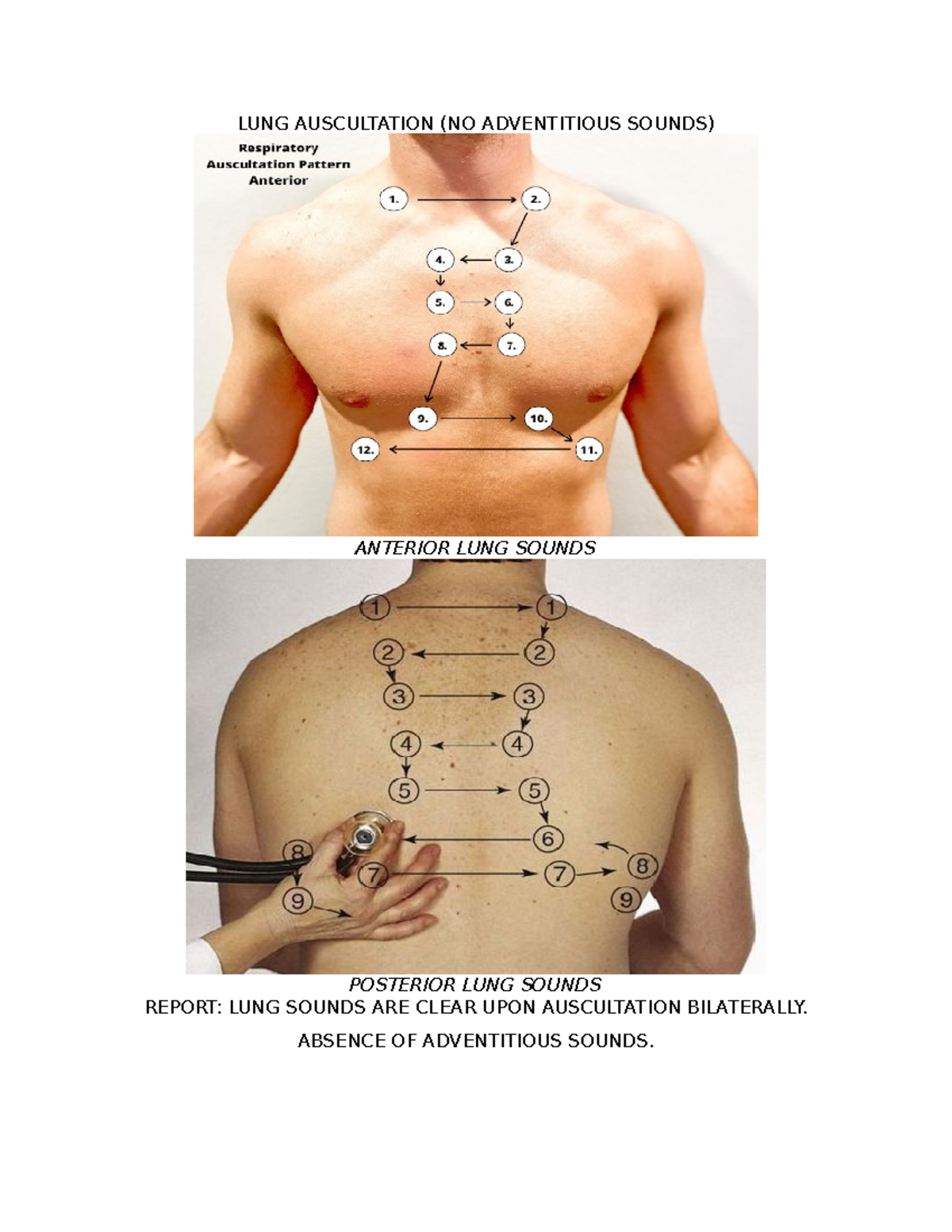 LUNG Auscultation - Good example for respiratory placement - NUR 101 ...