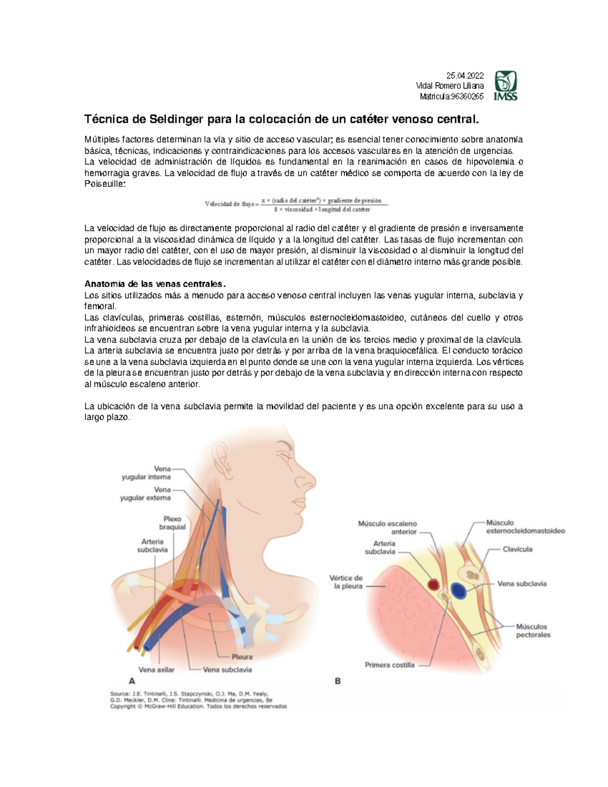 Técnica de Seldinger para Cateter Venoso Central - Matricula 96360265 - Document Preview