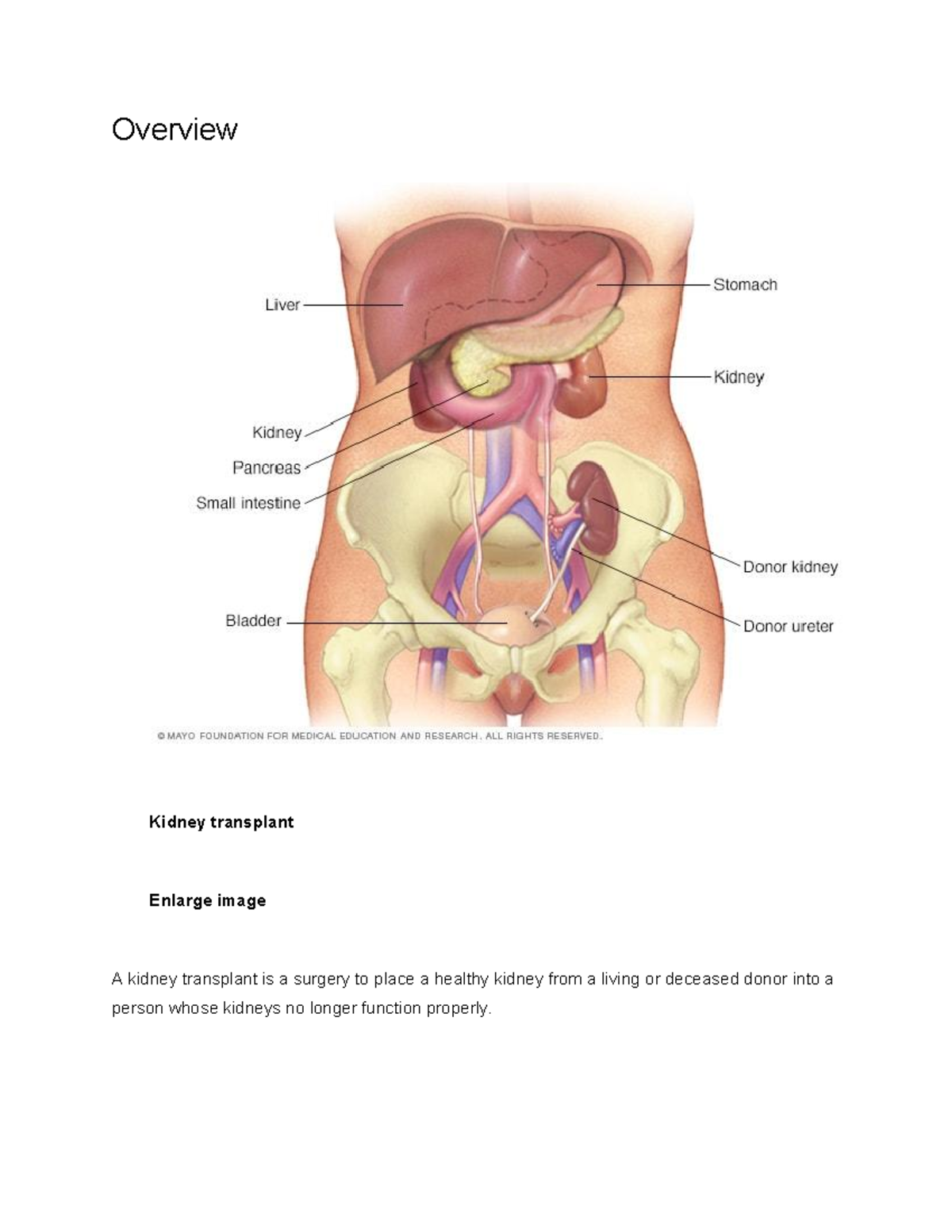 Kidney Transplant Overview: Procedure, Risks, and Post-Op Care - Studocu