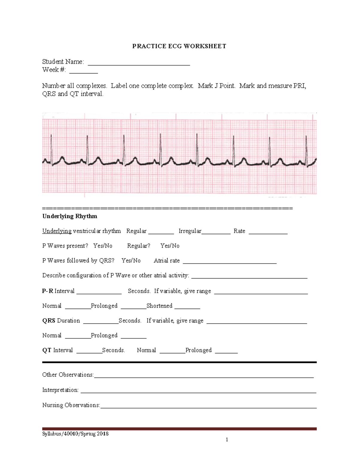 Practice ECG Worksheet - PRACTICE ECG WORKSHEET Student Name