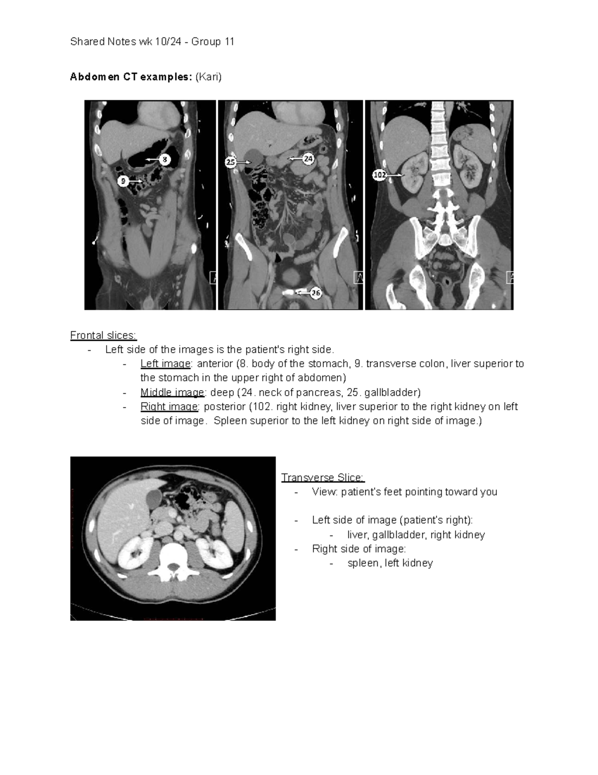 Abdomen CT Examples: Shared Notes wk Group 11 - Studocu