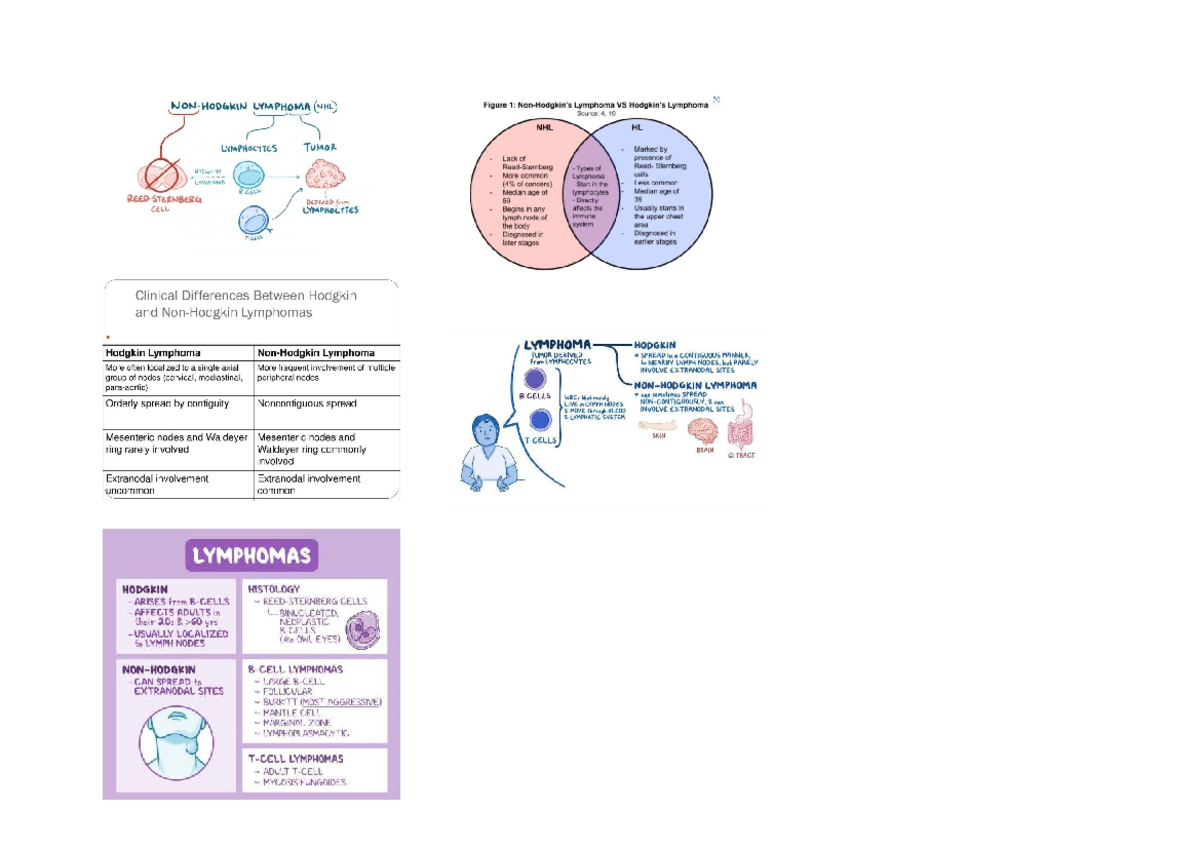 NHL Lymphoma Comparison: Hodgkin vs Non-Hodgkin Types - Studeersnel