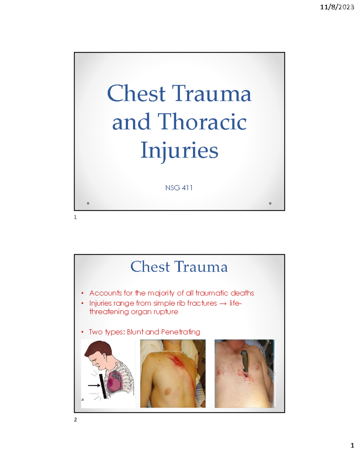 Chest trauma and thoracic injuries - Chest Trauma and Thoracic Injuries ...