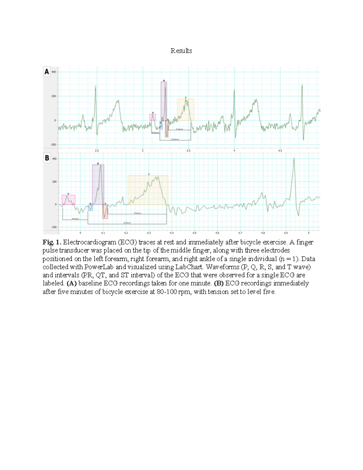 Lab 3: Cardiovascular Effects of Exercise on ECG and Heart Rate ...