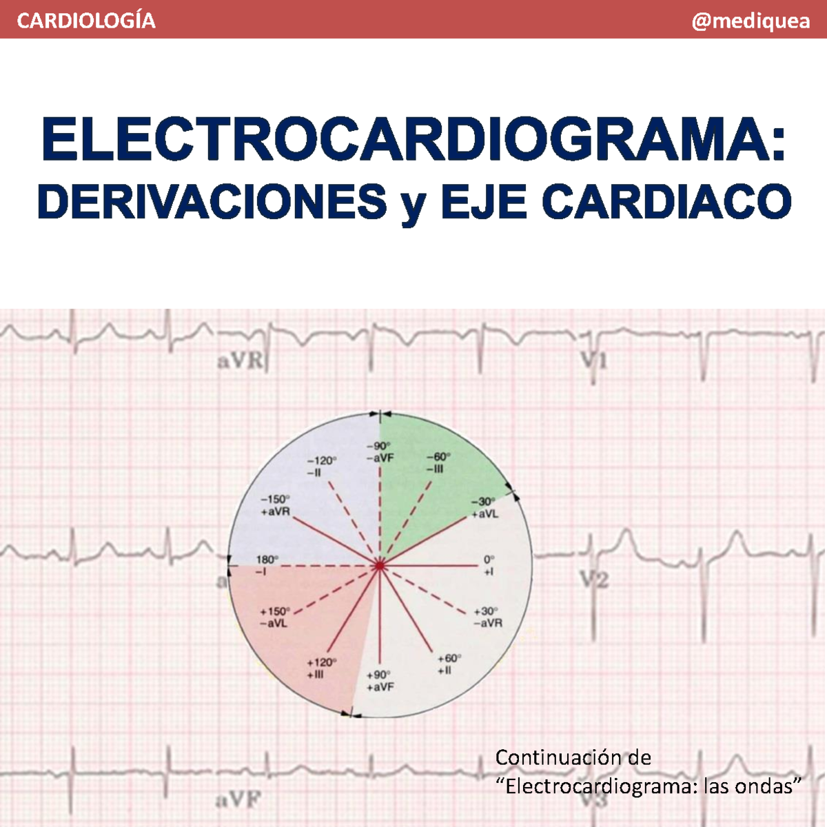 ecg-3-derivaciones-y-eje-card-aco-en-cardiolog-a-studocu