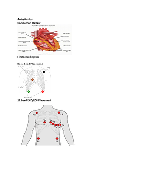 Test 3 notes - neuro - Chapter 61 – Management of patient with ...