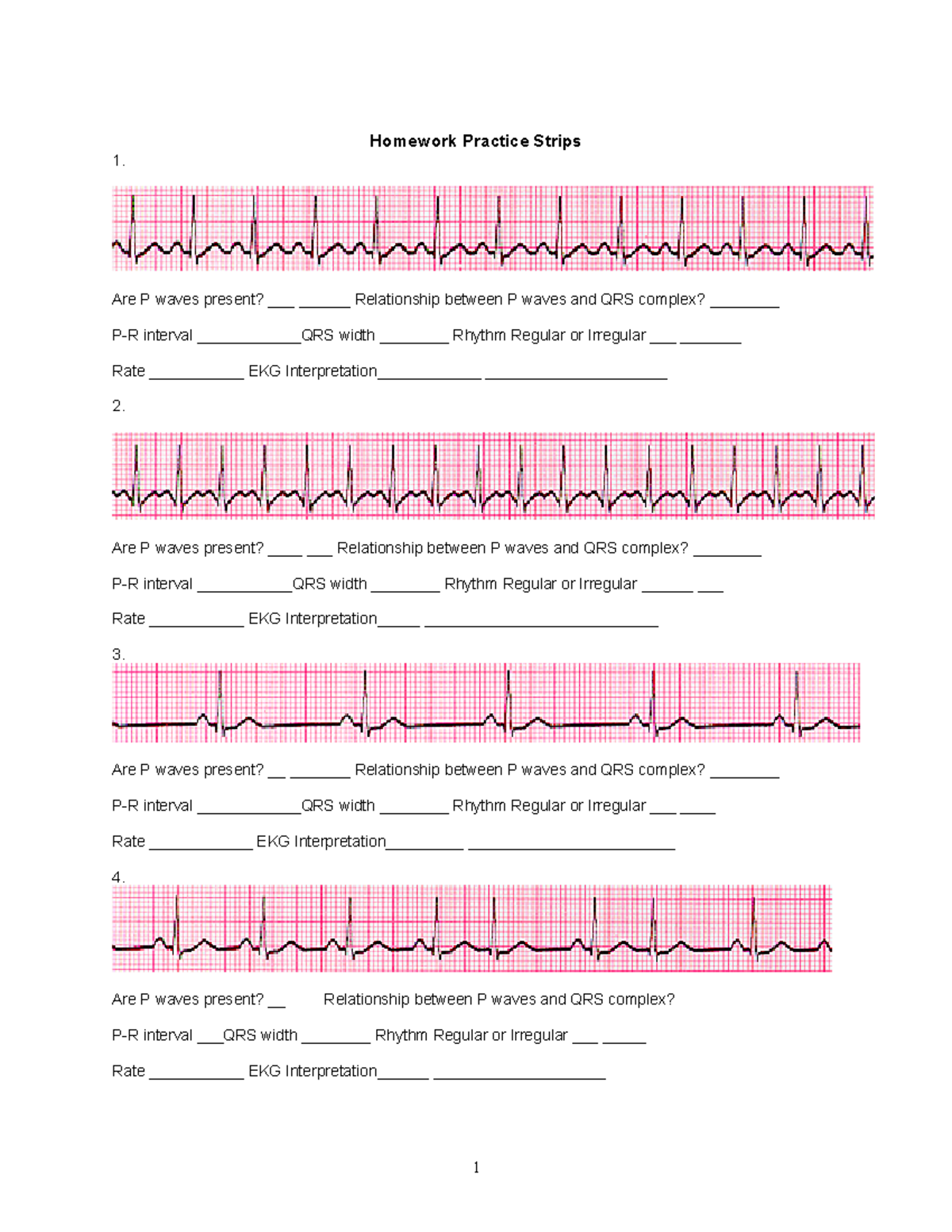 ECG Homework Handout 1: P Waves & QRS Complex Analysis - Studocu