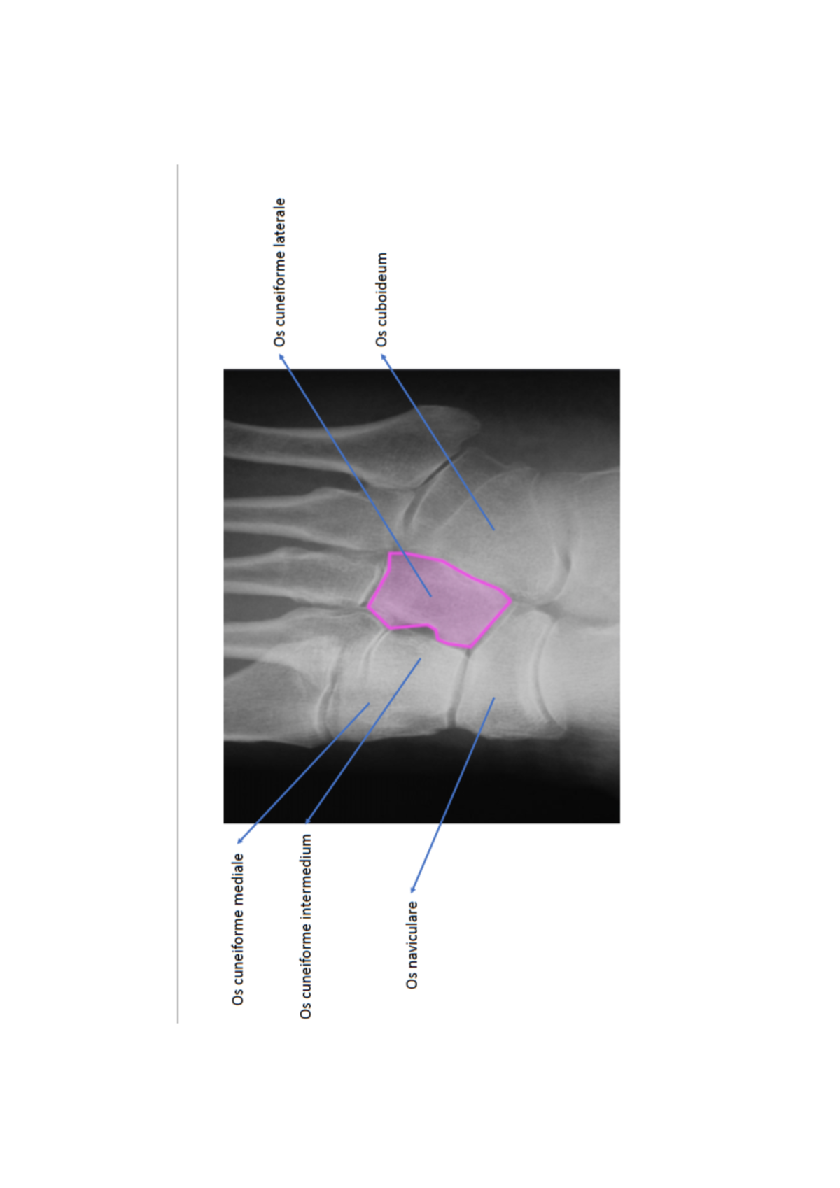 radiologie afbeelding - Locomotorisch stelsel en huid - Studocu