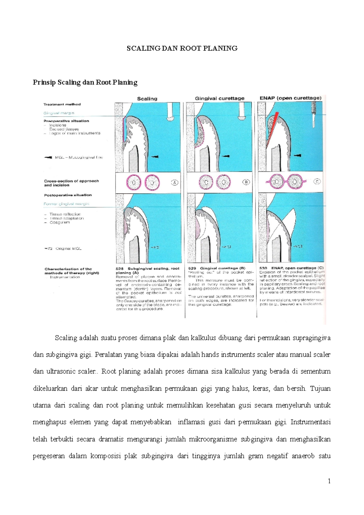 104702130 Scaling dan Root Planing: Panduan Lengkap dan Teknik - Studocu