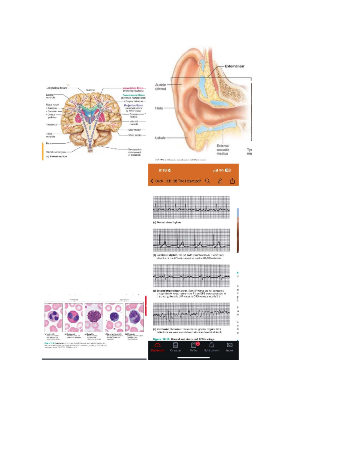 Document Review and Analysis: Insights and Reflections - External ear ...