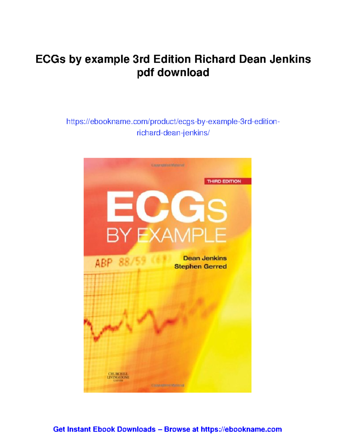 102316 - ECGs by Example, 3rd Edition by Richard Dean Jenkins - Studocu