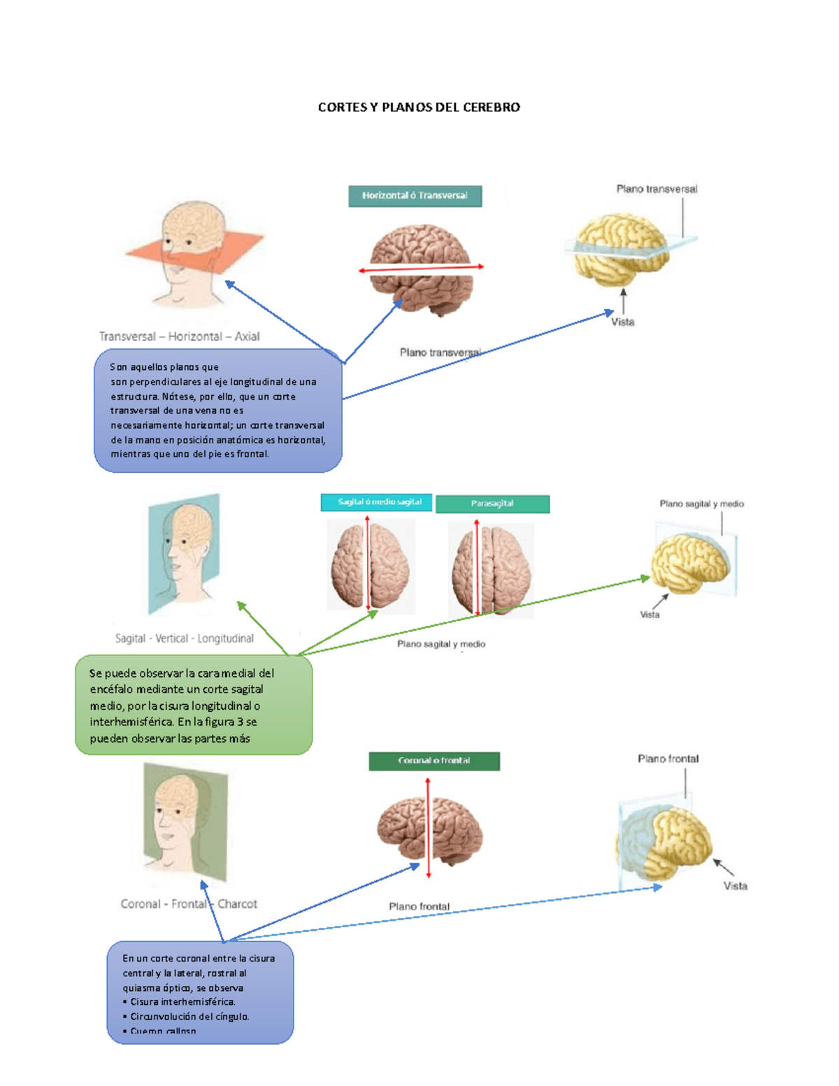 Planos Del Cerebro
