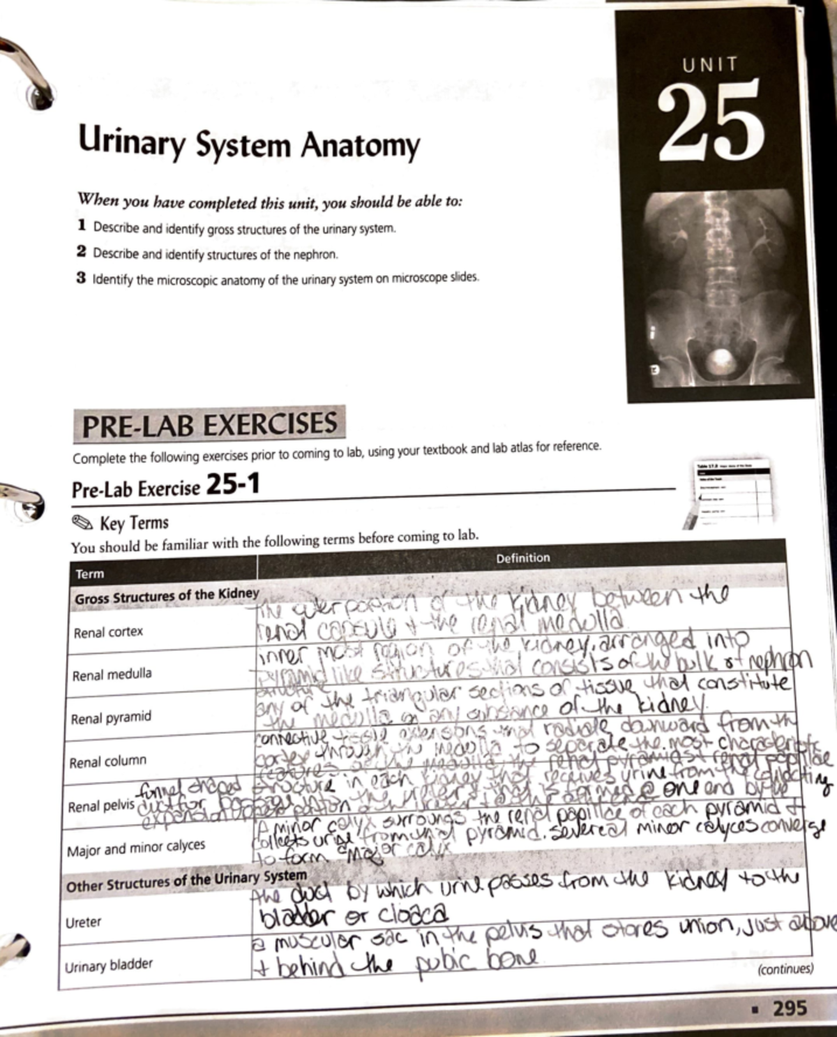 Unit 25 Prelab: Urinary System Anatomy Exercises and Key Terms - Studocu