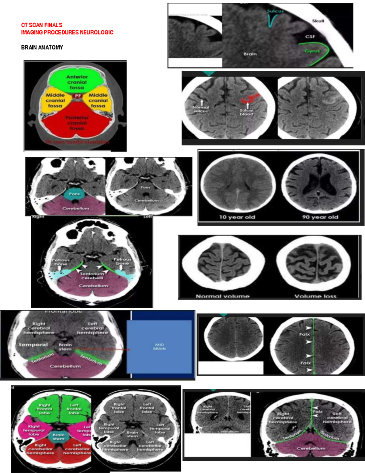 CT-SCAN-P1 - Basic Ct scan - CT SCAN FINALS IMAGING PROCEDURES ...