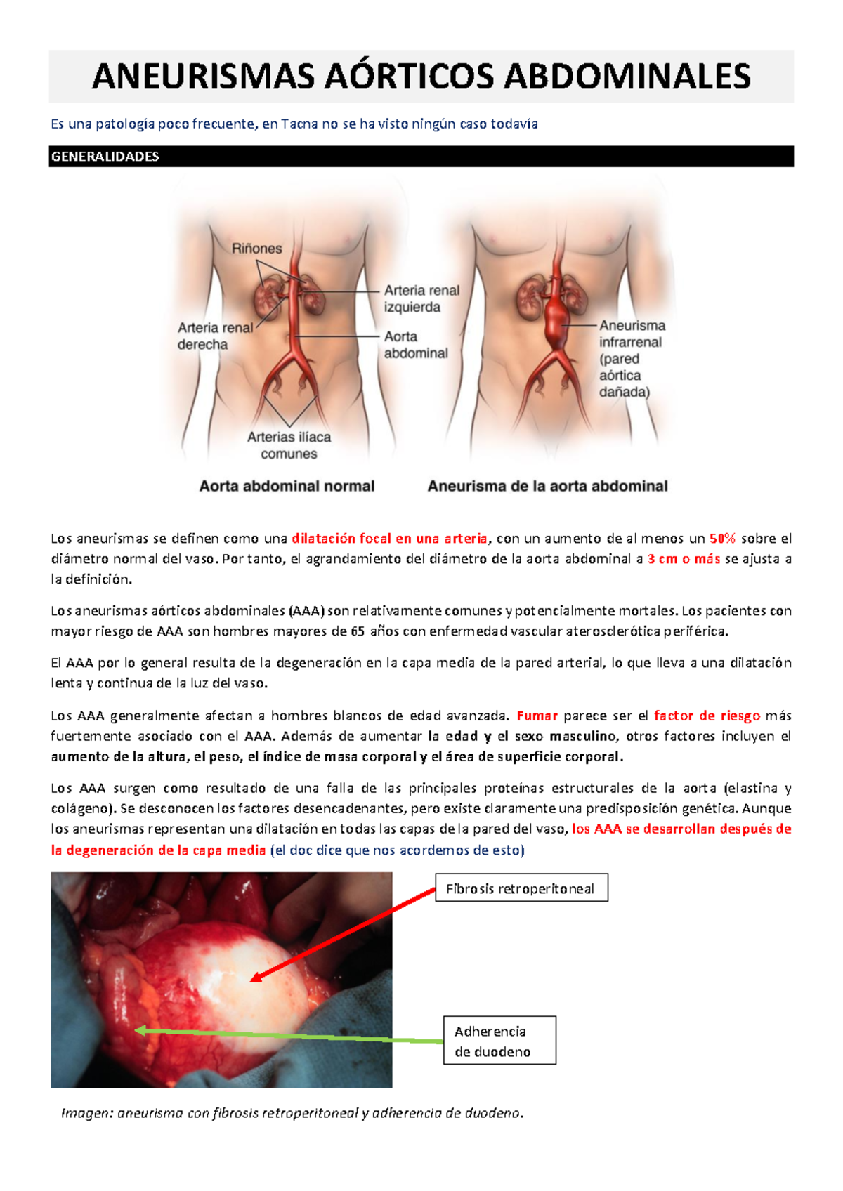 T21 - CX - Estudio sobre Aneurismas Aórticos Abdominales y su Manejo ...