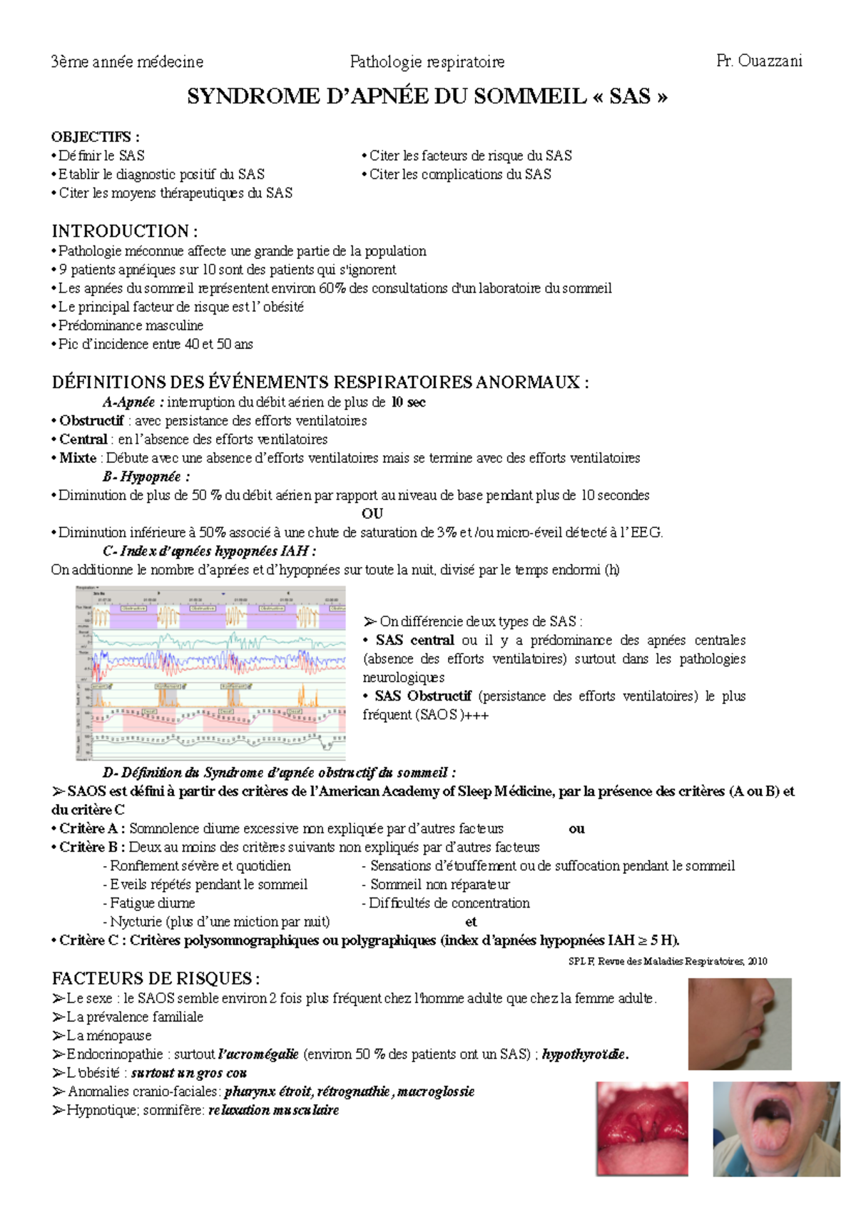 2- SAS - SAS - SYNDROME D’APNÉE DU SOMMEIL « SAS » OBJECTIFS : Définir ...