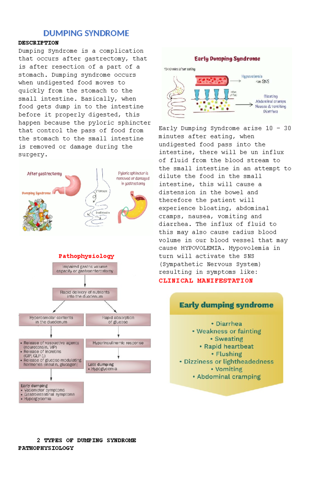 Dumping Syndrome Overview and Nursing Management Guide - Studocu