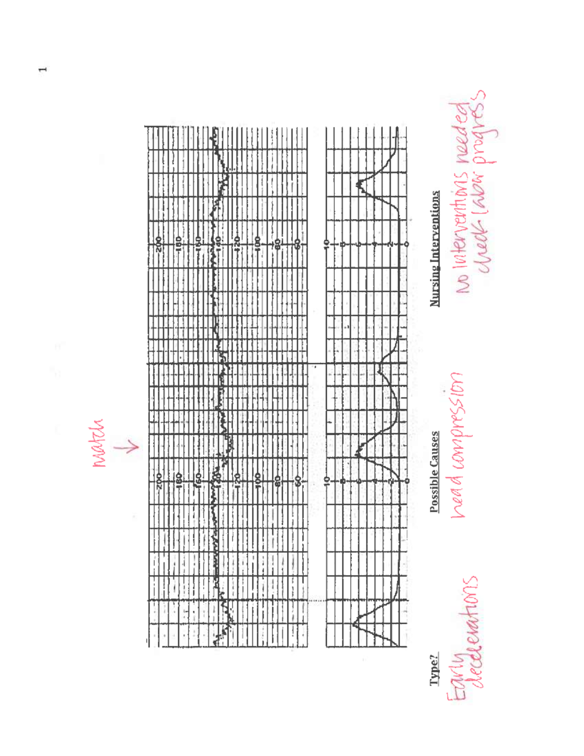 Fetal Heart Rate Decelerations: Causes and Interventions - Studocu