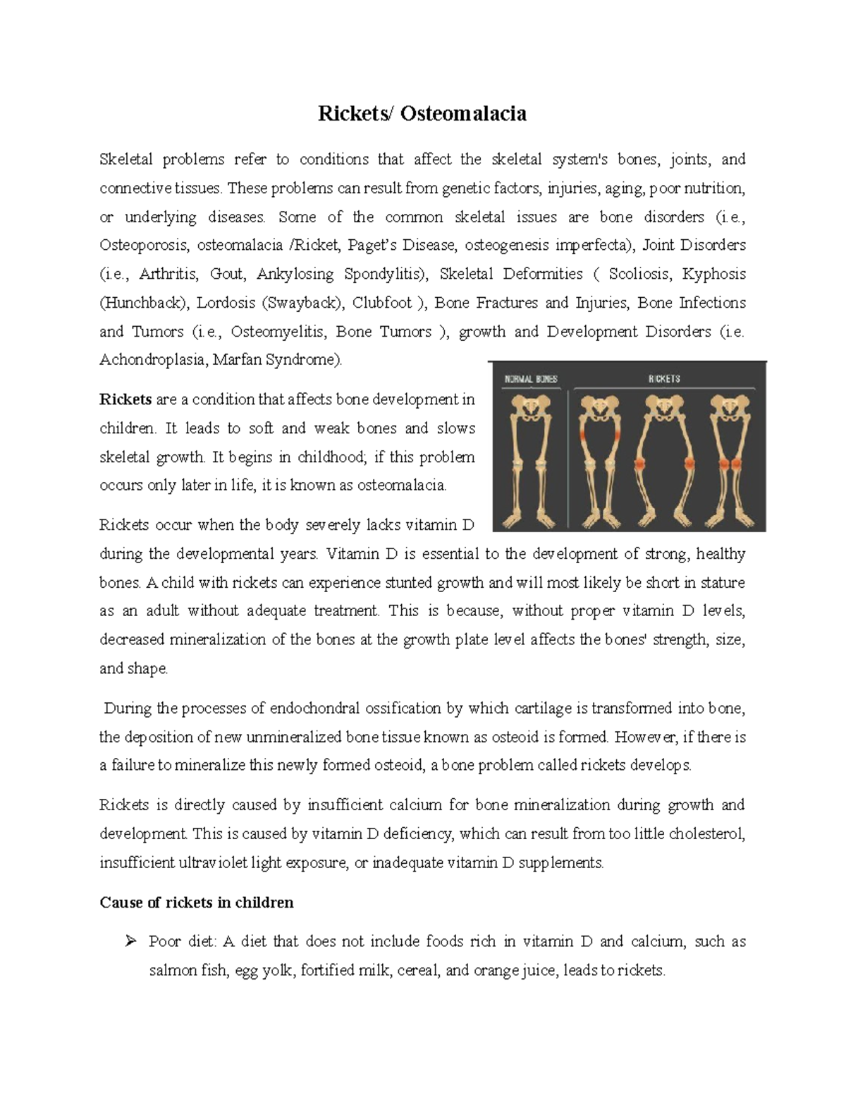 Riket - about ricket - Rickets/ Osteomalacia Skeletal problems refer to ...