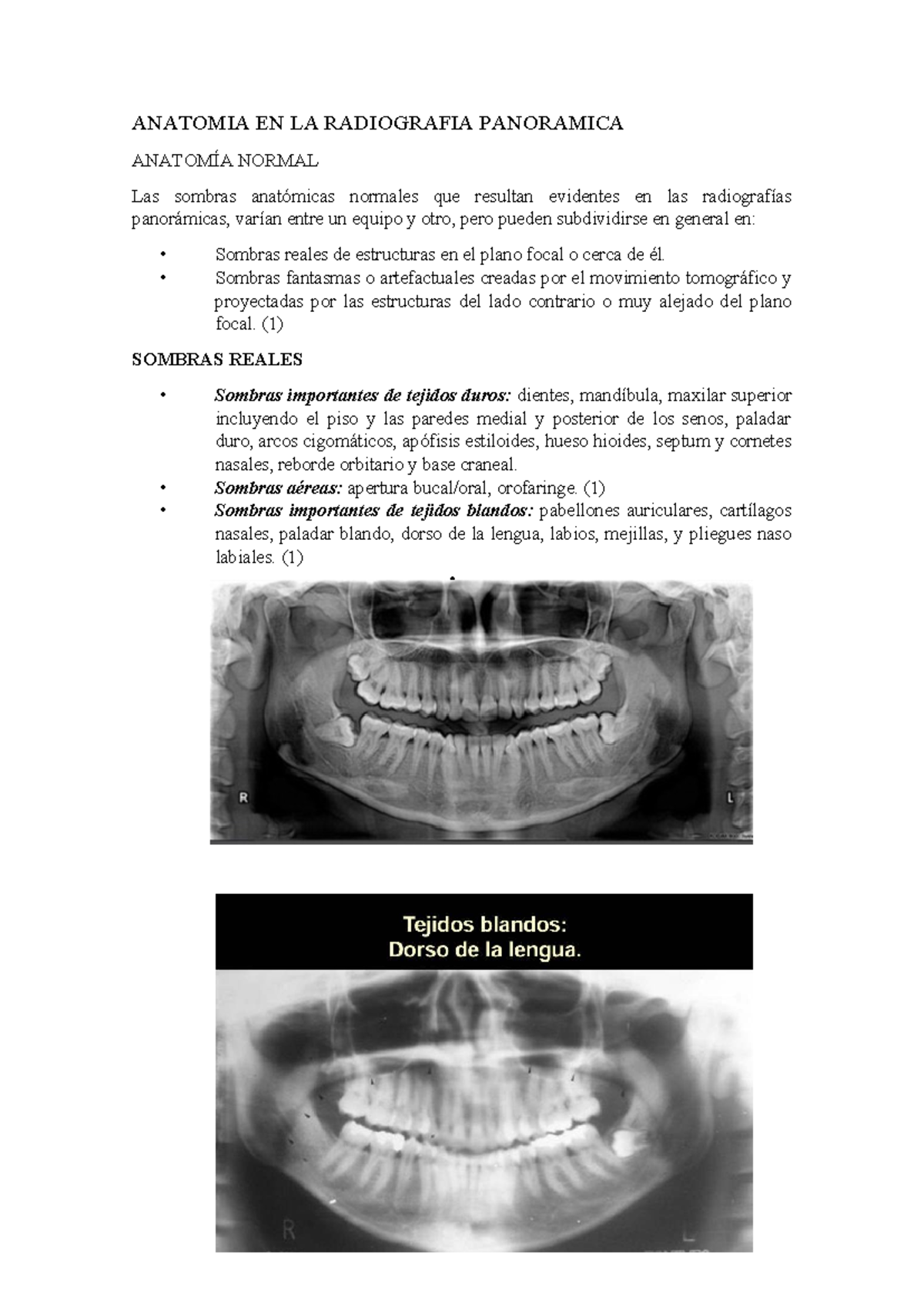 Anatomía De La Radiografía Panorámica 1340x624