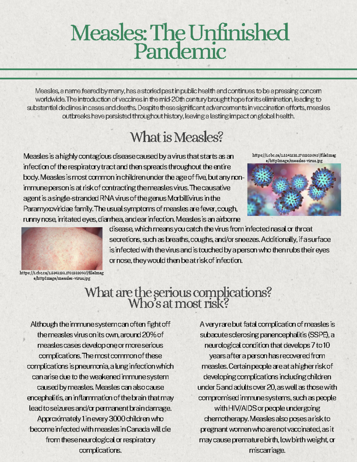 Measles: The Unfinished Pandemic - Final Exam Notes - Studocu